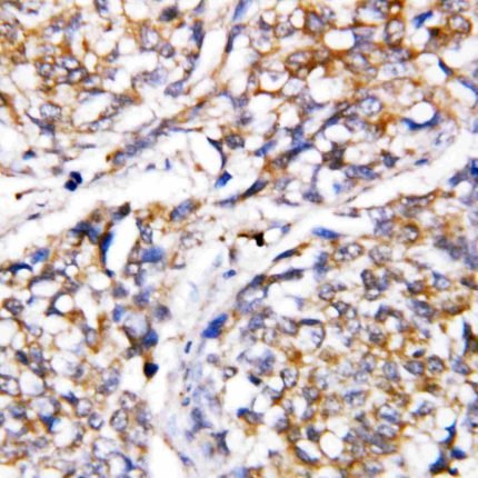 Caspase 4