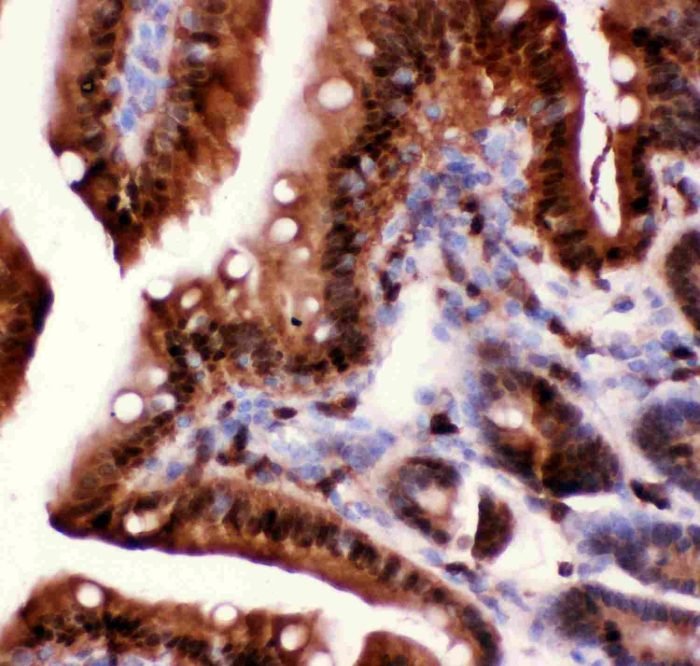 Caspase 5