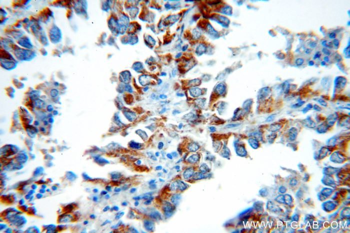 Caspase 10