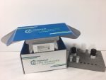 Human hepatitis B virus surface antigen,HBsAg ELISA Kit - Image 2