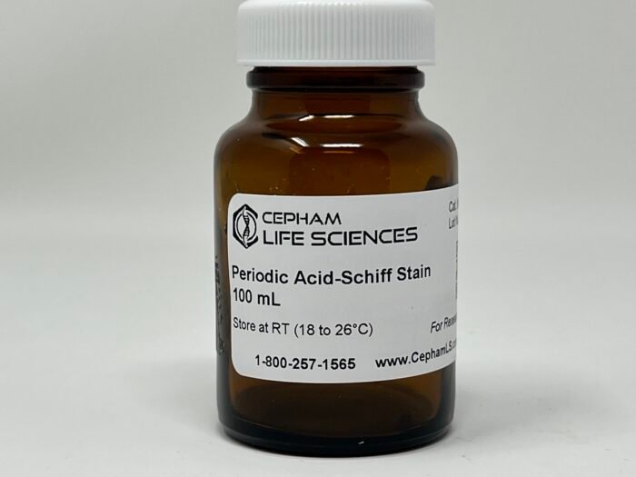 Periodic Acid-Schiff stain - Image 1